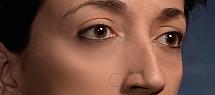 13-attenuation-pores.jpg