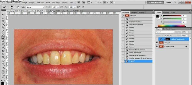 Comment blanchir des dents rapidement