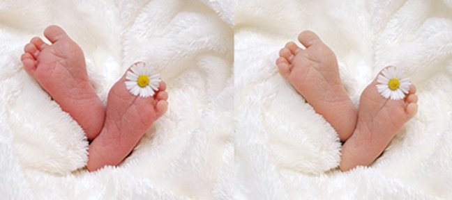 Photoshop : Corriger la teinte de la peau de bébé